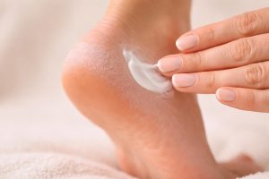 Crevasse Talon Douloureux : Comment Soulager et Soigner ?